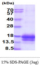 Epigen-sds-page - Product image 1