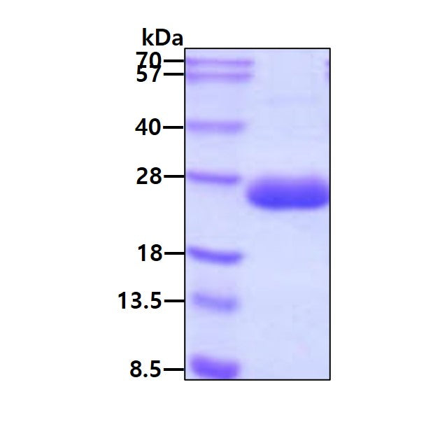 FGF21-sds-page - Product image 1