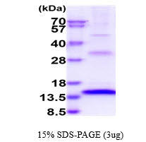 FGF23 Human, Sf9 - Product image 1