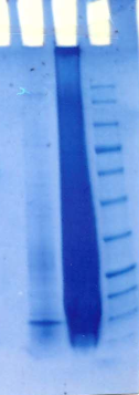 T.pallidum p15 (Partial), His sds-page - Product image 1