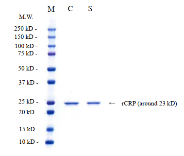 CRP Human Recombinant SDS-PAGE - Product image 1