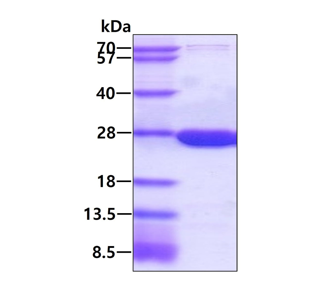 dhfr-human-sds-page - Product image 1