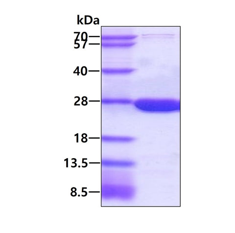 dhfr-human-sds-page - Product image 1