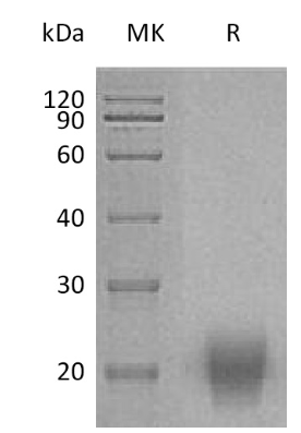 fsh human sds-page - Product image 1
