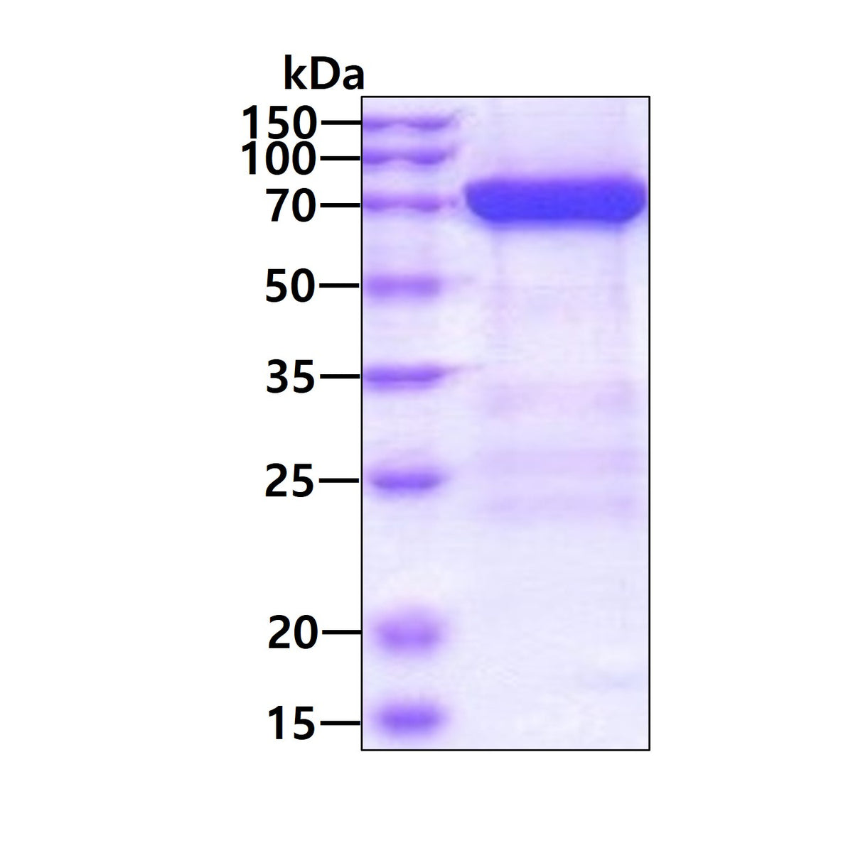 mx1 human sds-page - Product image 1