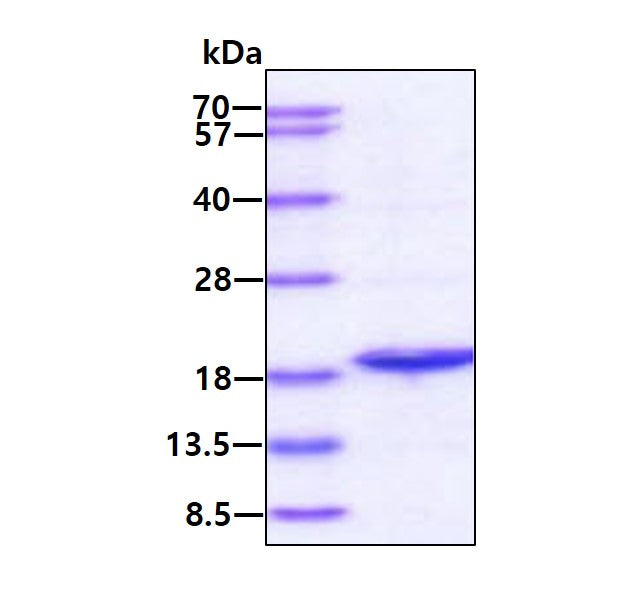 PPIL1 Human SDS-PAGE - Product image 1