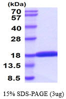 SF20 Human SDS-PAGE - Product image 1