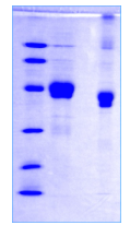 SFTPB Human SDS-PAGE - Product image 1